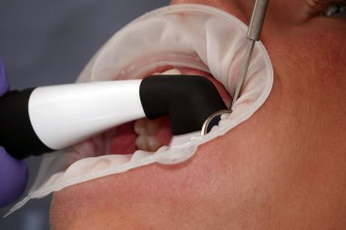 Kiev, Ukrayna 22 Ağustos 2020: Diş hekiminin aleti kapatıldı