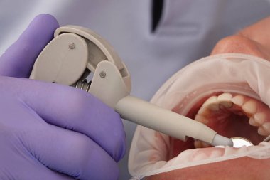 Kiev, Ukrayna 22 Ağustos 2020: Diş hekimi bir hastayla yakından ilgileniyor