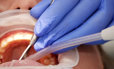 Kiev, Ukrayna 22 Ağustos 2020: Diş hekimi bir hastayla yakından ilgileniyor