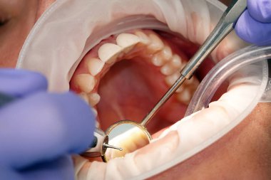 Kiev, Ukrayna 22 Ağustos 2020: Diş hekimi bir hastayla yakından ilgileniyor