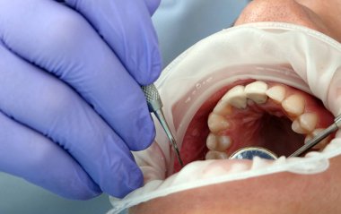 Kiev, Ukrayna 22 Ağustos 2020: Diş hekimi bir hastayla yakından ilgileniyor