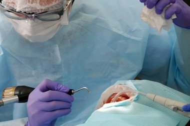 Kiev, Ukrayna 22 Ağustos 2020: Diş hekimi bir hastayla yakından ilgileniyor