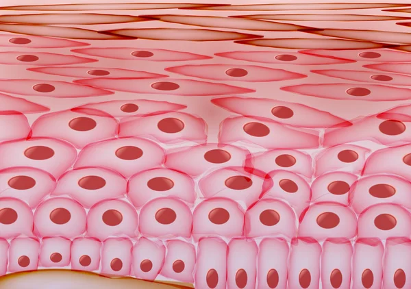 Cilt hücreleri, egzama, iltihaplı deri katmanları - vektör çizim