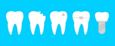 Dişleri farklı hastalıklarla dolu. Sağlıklı diş, çatlamış, kırılmış, dişleri, diş telleri ve diş implantı düz çizimlerde.