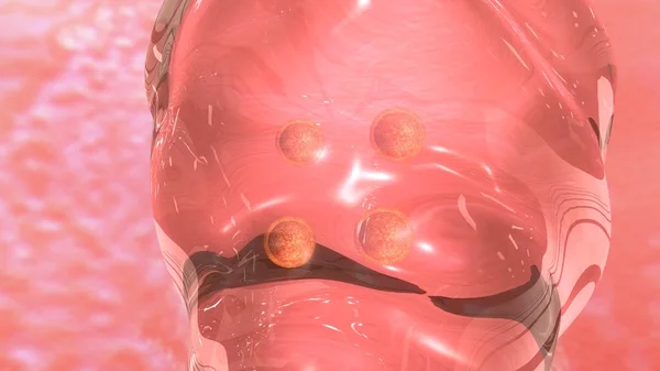 Trasferimento embrionale umano in fecondazione in vitro . — Foto Stock