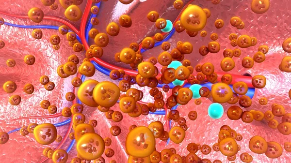 Wirus ludzkiego gruźlicy — Zdjęcie stockowe