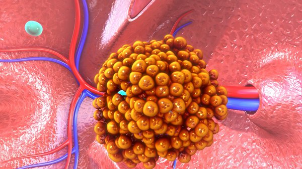 Вирус туберкулёза человека
