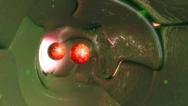 Células cancerígenas em vasos linfáticos — Fotografia de Stock