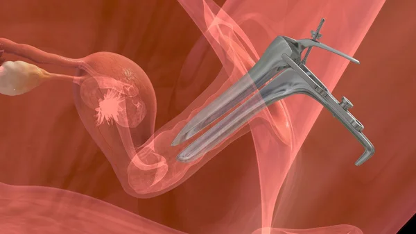 胚胎移植的过程 — 图库照片