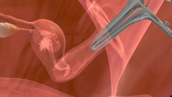 胚胎移植的过程 — 图库照片