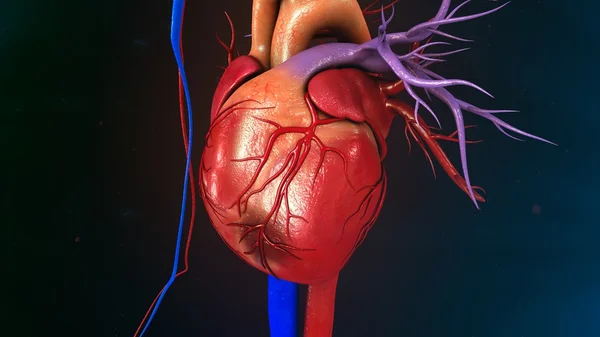 Infarctus du myocarde cardiaque — Photo