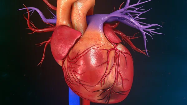 Srdeční infarkt myokardu — Stock fotografie