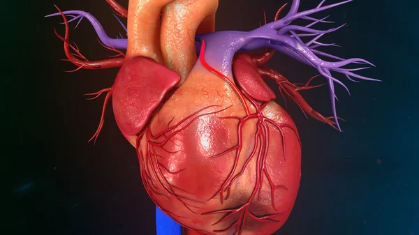 Infarto do miocárdio cardíaco — Fotografia de Stock