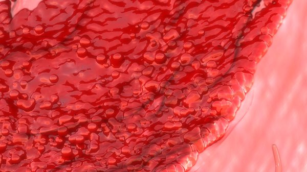 Female Menstruation bleeding