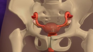 female uterus hysterectomy clipart