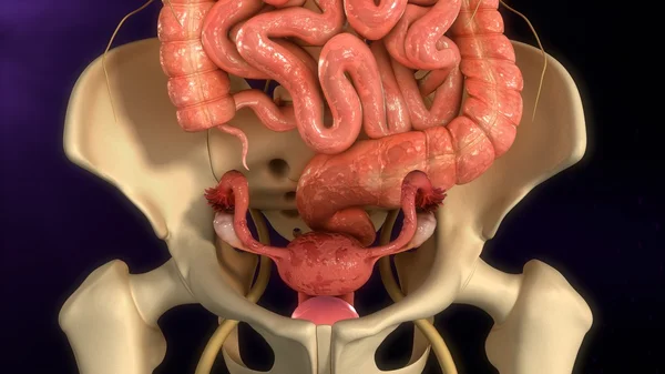 Rahim endometriozis hastalığı — Stok fotoğraf