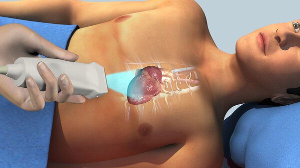 Эхокардиограмма пациента в больнице
