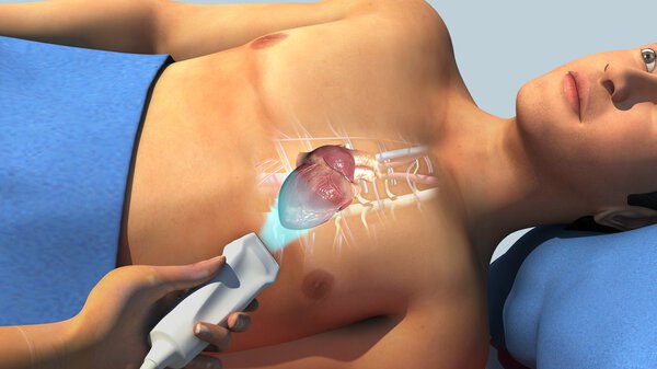 Эхокардиограмма пациента в больнице
