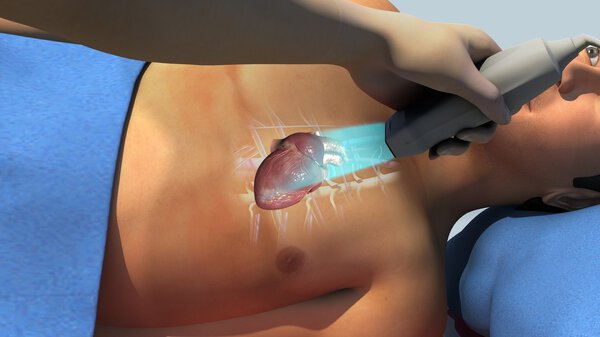 Эхокардиограмма пациента в больнице
