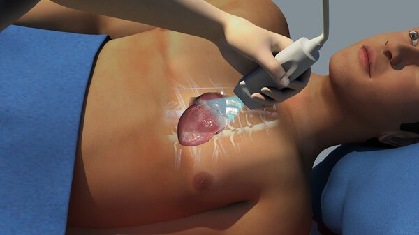 Эхокардиограмма пациента в больнице
