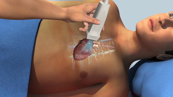 Эхокардиограмма пациента в больнице
