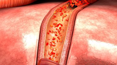 Kan akışında insan damar