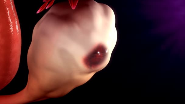 人間の卵巣嚢腫 — ストック動画