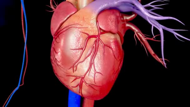 Cuore Infarto miocardico — Video Stock