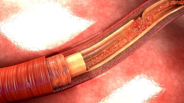 Anatomia da dissecção da artéria humana — Fotografia de Stock