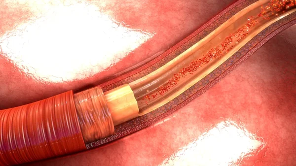 Anatomía de la arteria humana — Foto de Stock