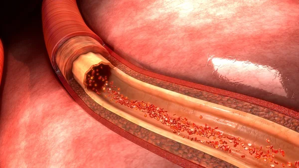 Anatomía de la arteria humana —  Fotos de Stock