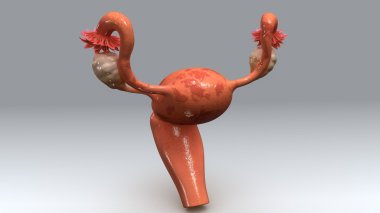 Uterus with Endometrial Tissue anatomy clipart