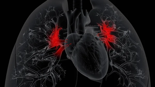 Ventrículo Derecho Bombea Sangre Los Pulmones Donde Oxigena Sangre Oxigenada —  Fotos de Stock