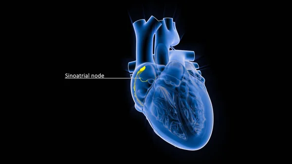 The sinoatrial node (also known as the sinuatrial node, SA node or sinus node) is a group of cells located in the wall of the right atrium of the heart.