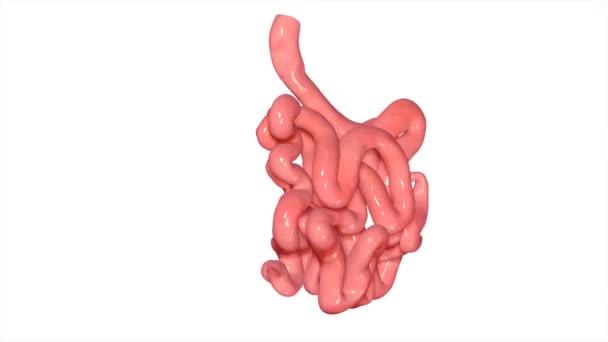 小腸炎 — ストック動画
