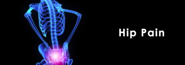 Kalça Ağrısı