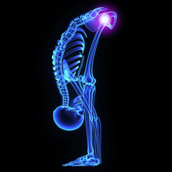 Hip joint — Stock Photo, Image