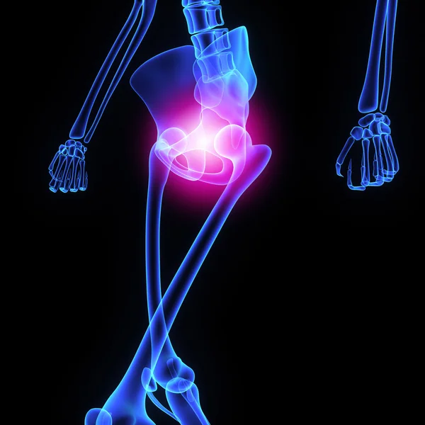 Articulação da anca — Fotografia de Stock