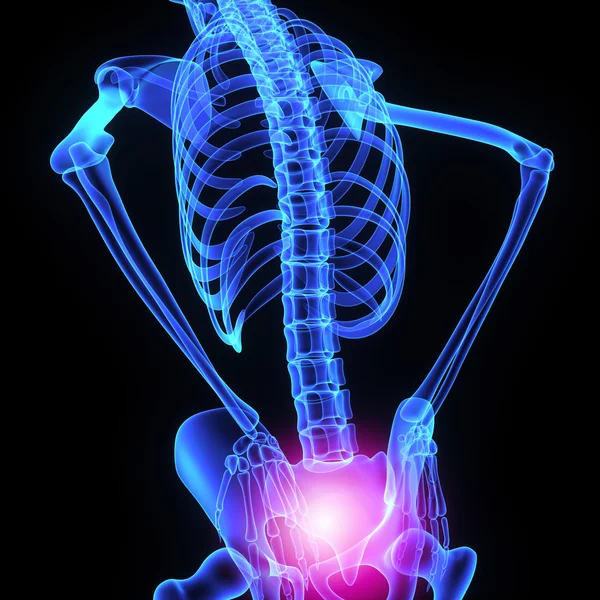Hip joint — Stock Photo, Image