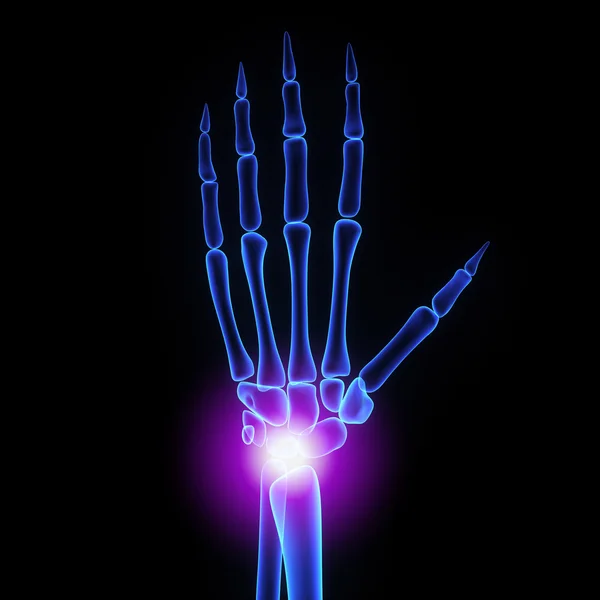 Wrist joint — Stock Photo, Image