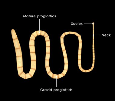Taenia solium, pork tapeworm