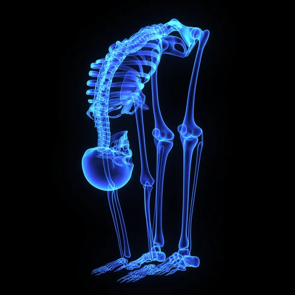 Hip joint — Stock Photo, Image