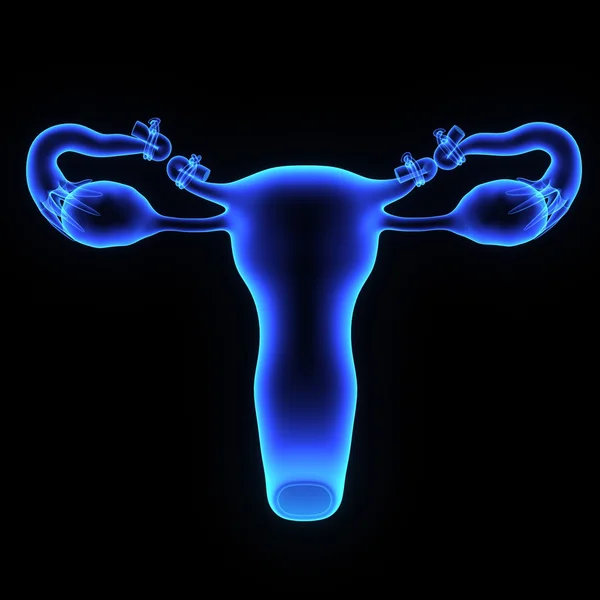 Tubectomy, fallopian tubes intervention — Stock Photo, Image