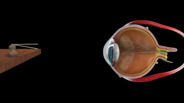 Hypermetropie normální oko