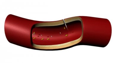 Plazma animasyon kavramı