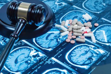 Jüpiter 'in Mallet' i manyetik rezonans ve özel haplarla birlikte. Sagliga adanmis hukukun kabulü. FOKUS GÜVENLİK.