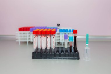 10 Kasım 2020 Chisinau Moldova Vakum kan örnekleme sistemi bir Vacuette konteynırında. Klinikteki analizler. İllüstrasyon Editörü