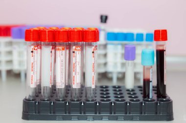 10 Kasım 2020 Chisinau Moldova Vakum kan örnekleme sistemi bir Vacuette konteynırında. Klinikteki analizler. İllüstrasyon Editörü