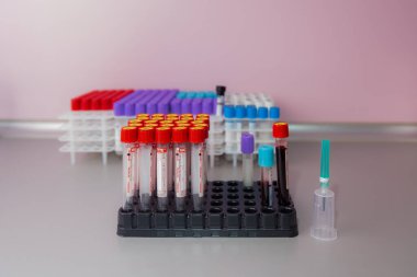 10 Kasım 2020 Chisinau Moldova Vakum kan örnekleme sistemi bir Vacuette konteynırında. Klinikteki analizler. İllüstrasyon Editörü