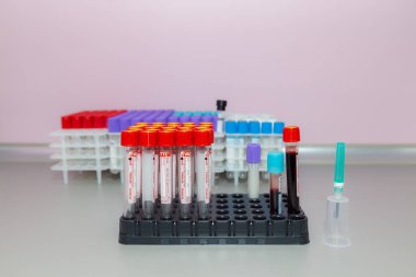 10 Kasım 2020 Chisinau Moldova Vakum kan örnekleme sistemi bir Vacuette konteynırında. Klinikteki analizler. İllüstrasyon Editörü